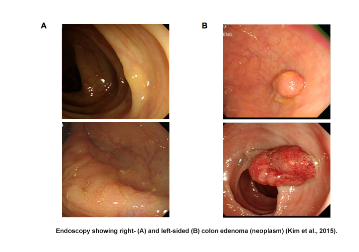 proximal and distal colon images