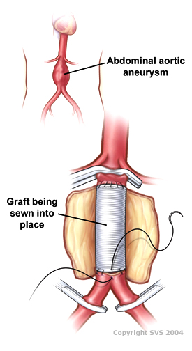 SurgicalAAA 01 Base 275.jpg