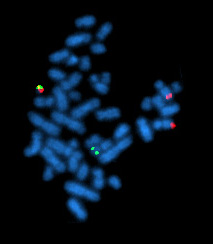 Zdjęcie w metodzie fluorescencyjnej, na którym widać chromosomy zabarwione na niebiesko; w niektórych miejscach widoczne czerwone i zielone kropki oznaczające miejsce translokacji