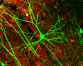 Pyramidal neuron visualized by green fluorescent protein (gfp)