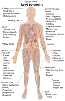 A chart of a human body with arrows pointing pieces of text to different parts of the body