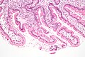 Duodenal biyopside giardiyazı gösteren mikrograf (H&E lekesi)