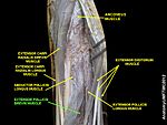 Extensor pollicis brevis muscle