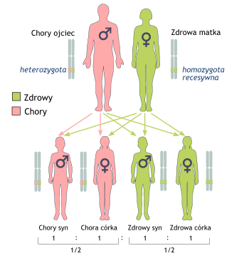 Schematyczne przedstawienie rodziców i możliwości dziedziczenia choroby przez ich dzieci; ojciec chory, matka zdrowa, istnieje 50% szansy na to, że dziecko (bez względu na płeć) również będzie chore