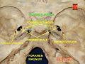 Foramen lacerum