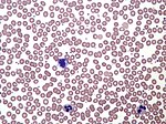 Normal human blood film