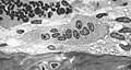 Light micrograph of an osteoclast displaying typical distinguishing characteristics: a large cell with multiple nuclei and a "foamy" cytosol.