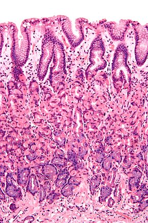 Mucous membrane