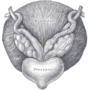 Thumbnail for Prostatectomy