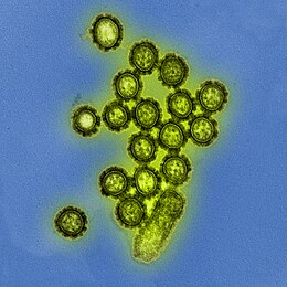 Description de l'image H1N1 Influenza Virus Particles (8411599236).jpg.