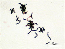 Bifidobacterium adolescentis