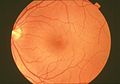 A normal human fundus