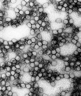 Eletromicrografia de transmissão do vírus da Febre Amarela