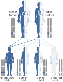 Illustration of autosomal recessive inheritance. Each parent has one blue allele and one white allele. Each of their 4 children inherit one allele from each parent such that one child ends up with two blue alleles, one child has two white alleles and two children have one of each allele. Only the child with both blue alleles shows the trait because the trait is recessive.