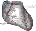 Thumbnail for Left anterior descending artery