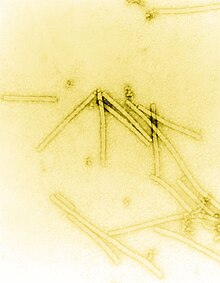 Electron micrograph of rod shaped TMV particles.