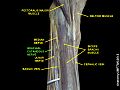 brachial cutaneous nerve