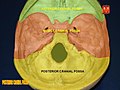 Posterior cranial fossa