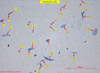 Airborne fungal spores