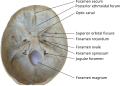 Labeled photo of foramina of skull base.