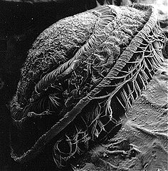 Trichodina sp. (micrographie électronique)