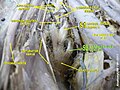 Sacral spinal nerve 2