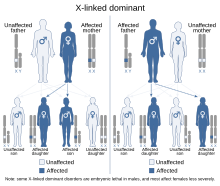 X-linked dominant inheritance scenarios for either the mother or father being affected