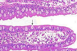 Cellules caliciformes dans la paroi d'un vili iléon. Sur ses côtés, les entérocytes sont visibles sur un noyau de lamina propria.