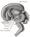 Median sagittal section of brain of human embryo of three months