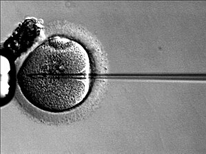 Image of Invitro Fertilisation