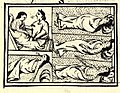 Image 55Depiction of smallpox in Franciscan Bernardino de Sahagún's history of the conquest of Mexico, Book XII of the Florentine Codex, from the defeated Aztecs' point of view (from History of medicine)