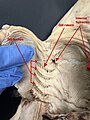 Image 22A ventral dissection of a pregnant female dogshark exposing its internal gill slits and internal spiracles. (from Shark anatomy)