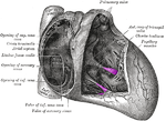 Thumbnail for Papillary muscle