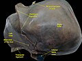 Bare area of the liver.Diaphragmatic surface of liver.