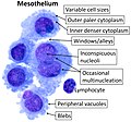 Cytology of the normal mesothelial cells that line the peritoneum, with typical features.[2] Wright's stain