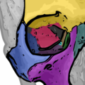 Orbital bones. Lacrimal bone shown in green.