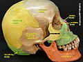 Parietal bone