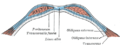 Diagram of sheath of Rectus.