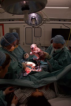 Caesarean section