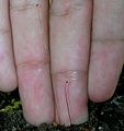 Phycomyces sporangium with fingers for size comparison