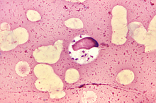 Leishmania donovani 01.png