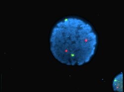 Núcleo de linfócitos humanos coloridos com DAPI com o cromossoma 13 (verde) e 21 (vermelho) sondas centrómero hibridizadas (hibridização fluorescente in situ (FISH))