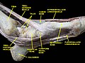 Articulación del tobillo. Disección profunda. Vista medial.