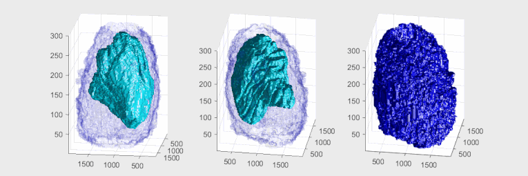 Plasma membrane and nuclear envelope of one Hela cell, displayed as a volumetric surface rendering. Left and centre: the plasma membrane in blue, with transparency, and the nuclear envelope in solid cyan. Right: the plasma membrane without transparency and the same angle of view as the centre picture. The membranes have been segmented from data acquired by electron microscopy.