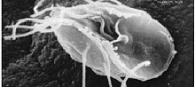 "Giardia lamblia", a parasitic diplomonad