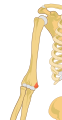 Right medial epicondyle colored in red.