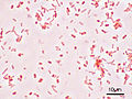 Salmonella typhimurium in der Gramfärbung 1000-fach vergrößert