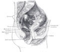 Feminae situs anatomicus abdominalis - Vesica urinaria excavatione vesicouterina ab utero ex parte separata