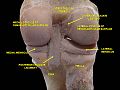 Knee joint. Deep dissection. Posterior view.