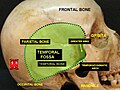 Temporal fossa and parietal bone